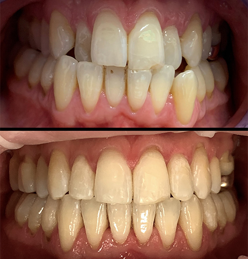 David Invisalign in Huddersfield